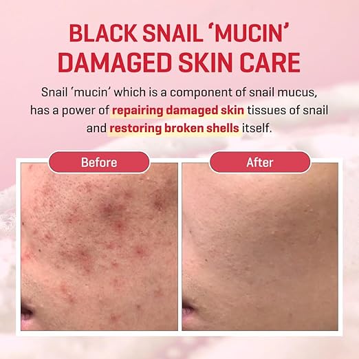 Some By Mi Snail Truecica Miracle Repair Serum Red 50ml -.