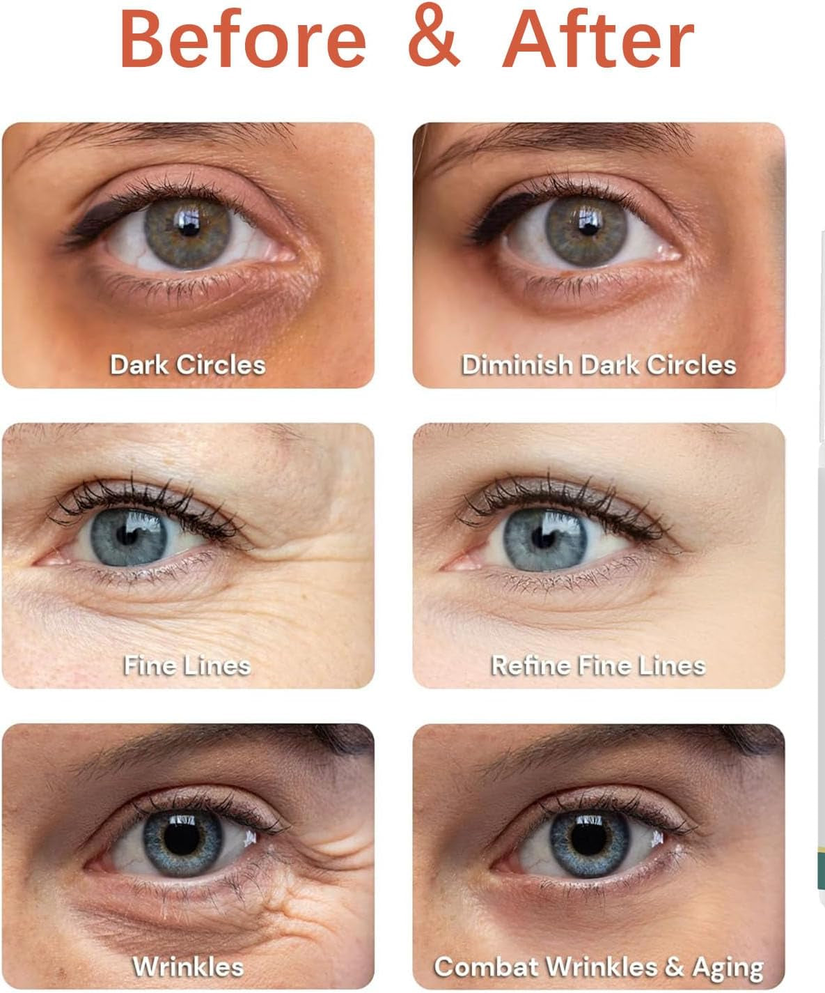 Jasmine Ointment Eye Cream for Dark Circles and Wrinkles