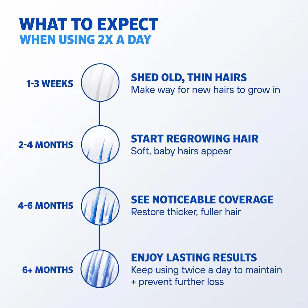 Men’s Rogaine (Topical Solution)